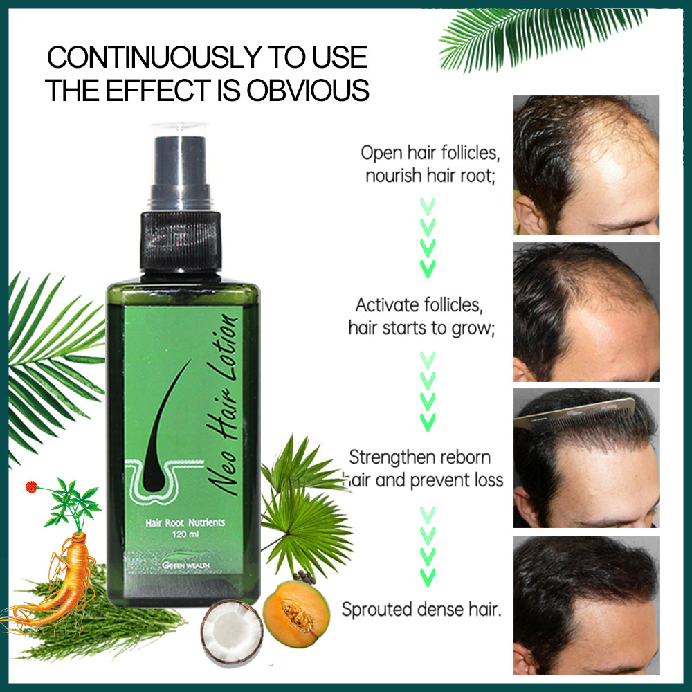4 pcs Neo Hair Lotion 120ml Ha - огляд і ціна Nutrition And Fitness